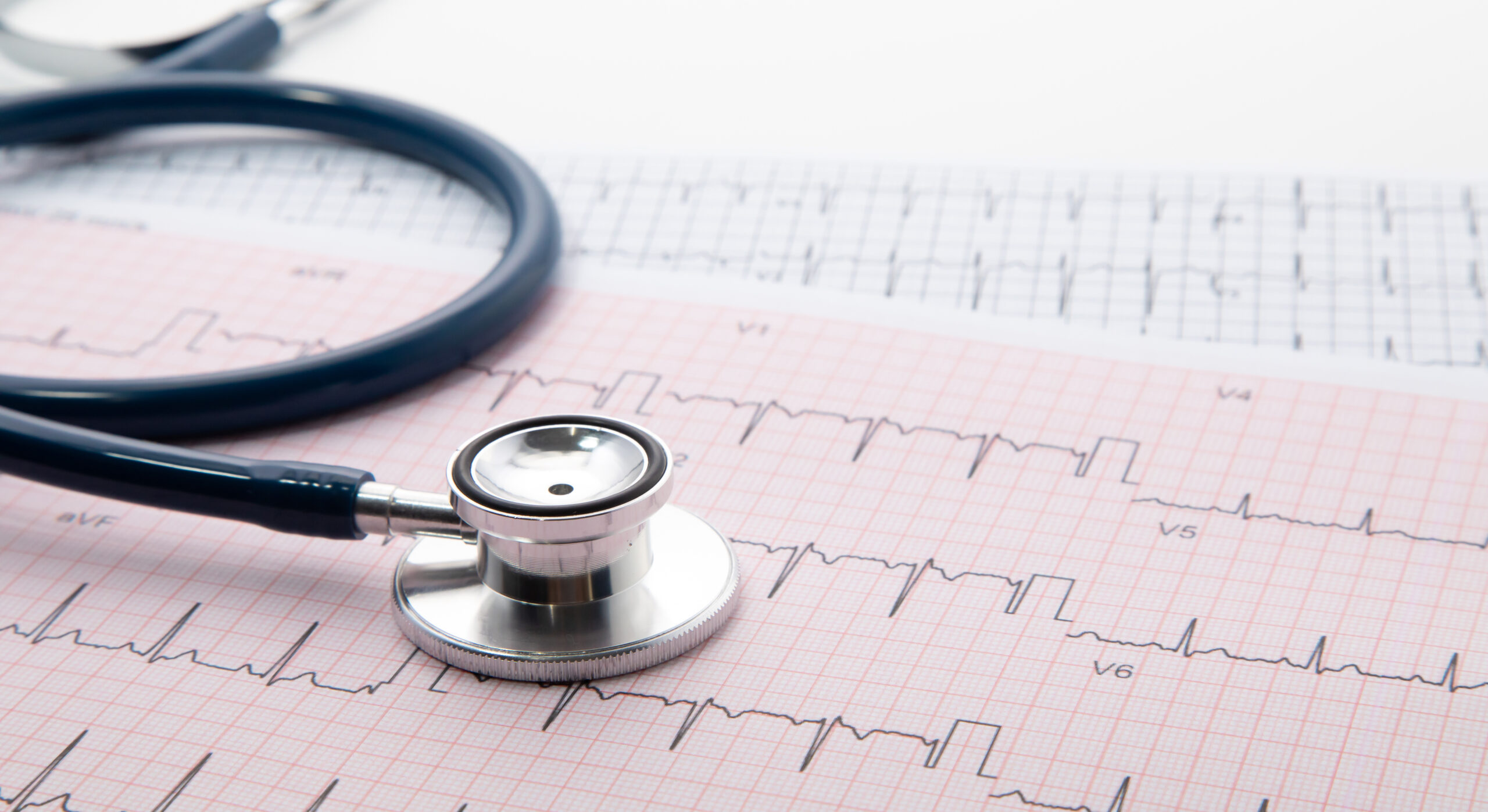 Blue Stethoscope on electrocardiogram (ECG) chart paper. ECG hea